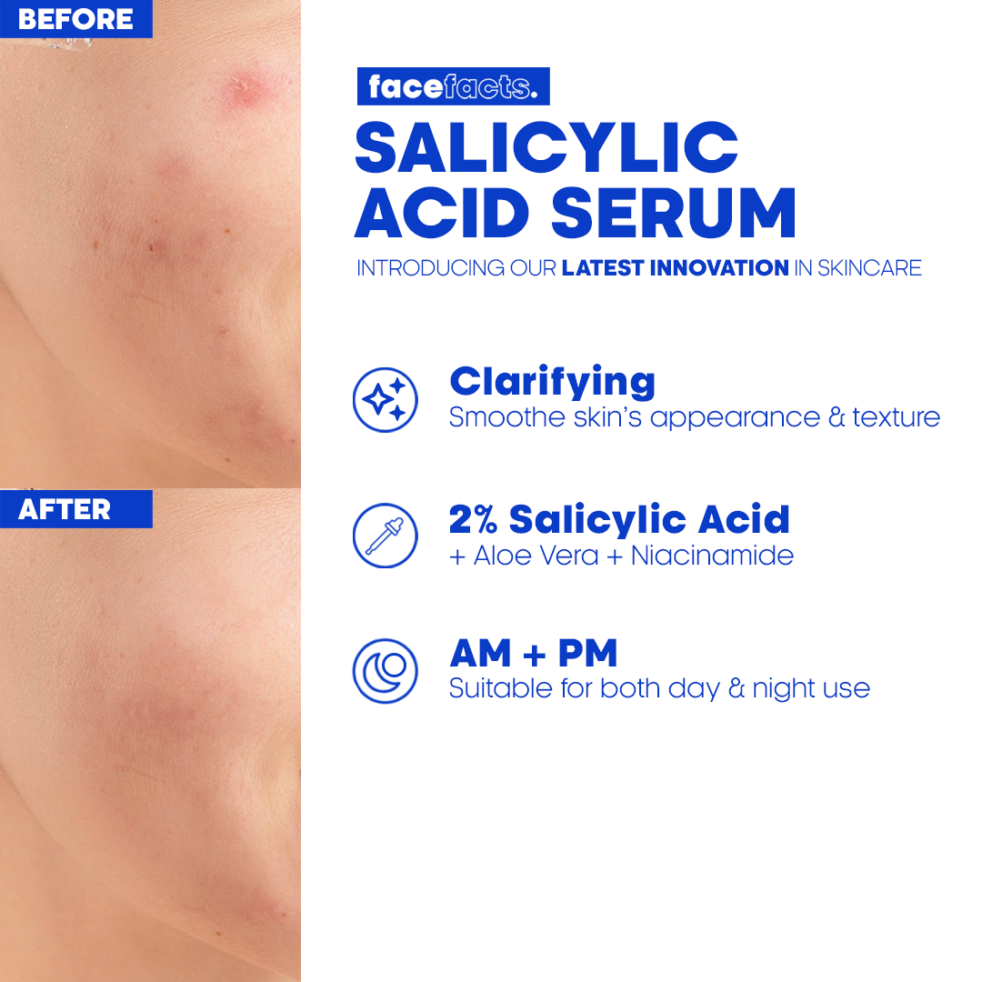 2% Salicylic Acid Serum