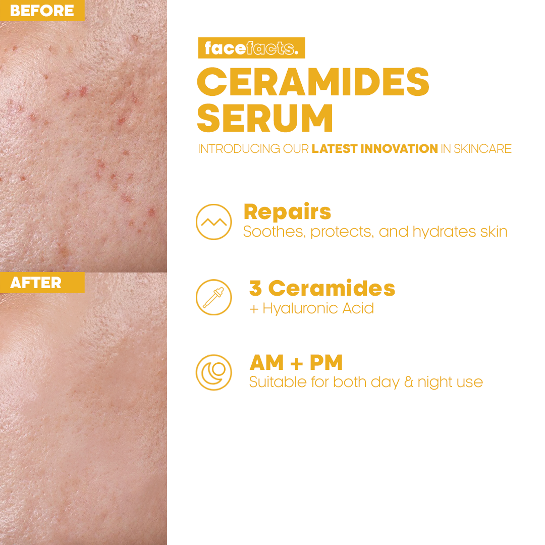 Ceramides Serum